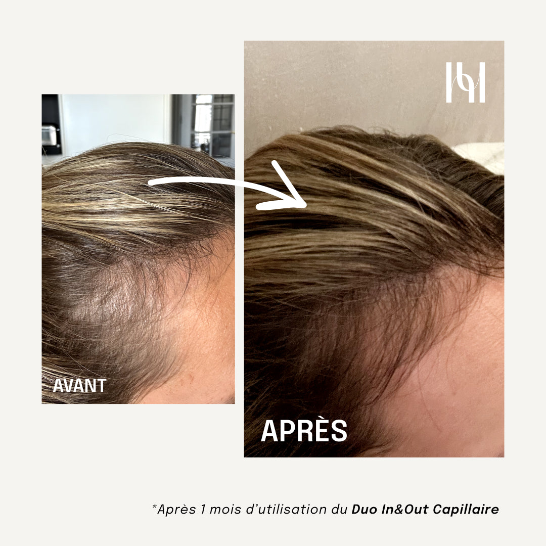 Huile OUT Capillaire