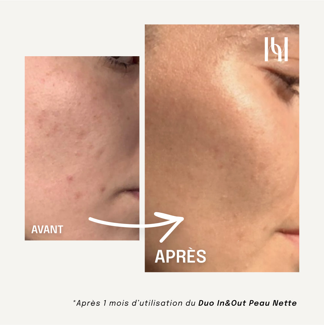 Duo IN&OUT Peau Nette