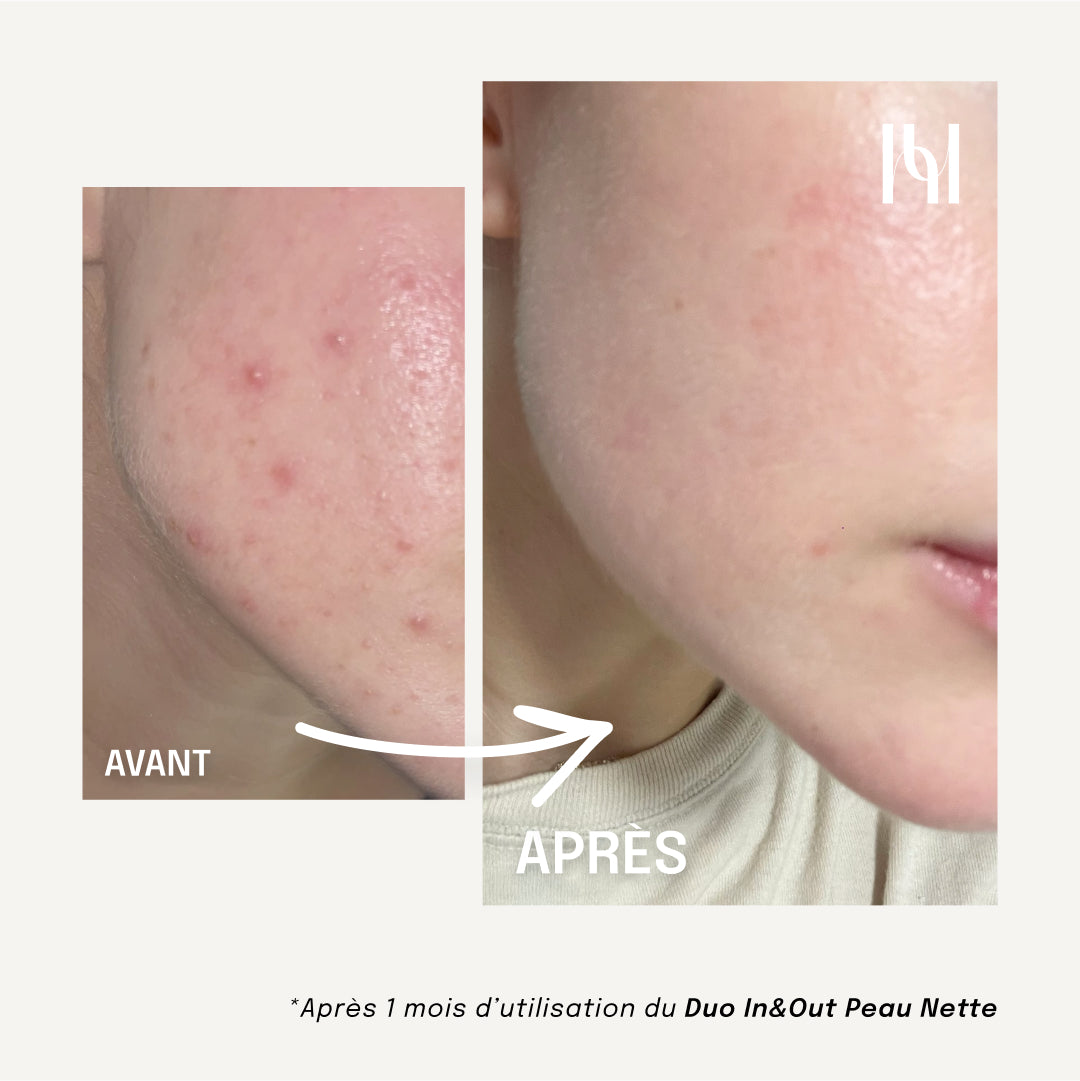 Duo IN&OUT Peau Nette