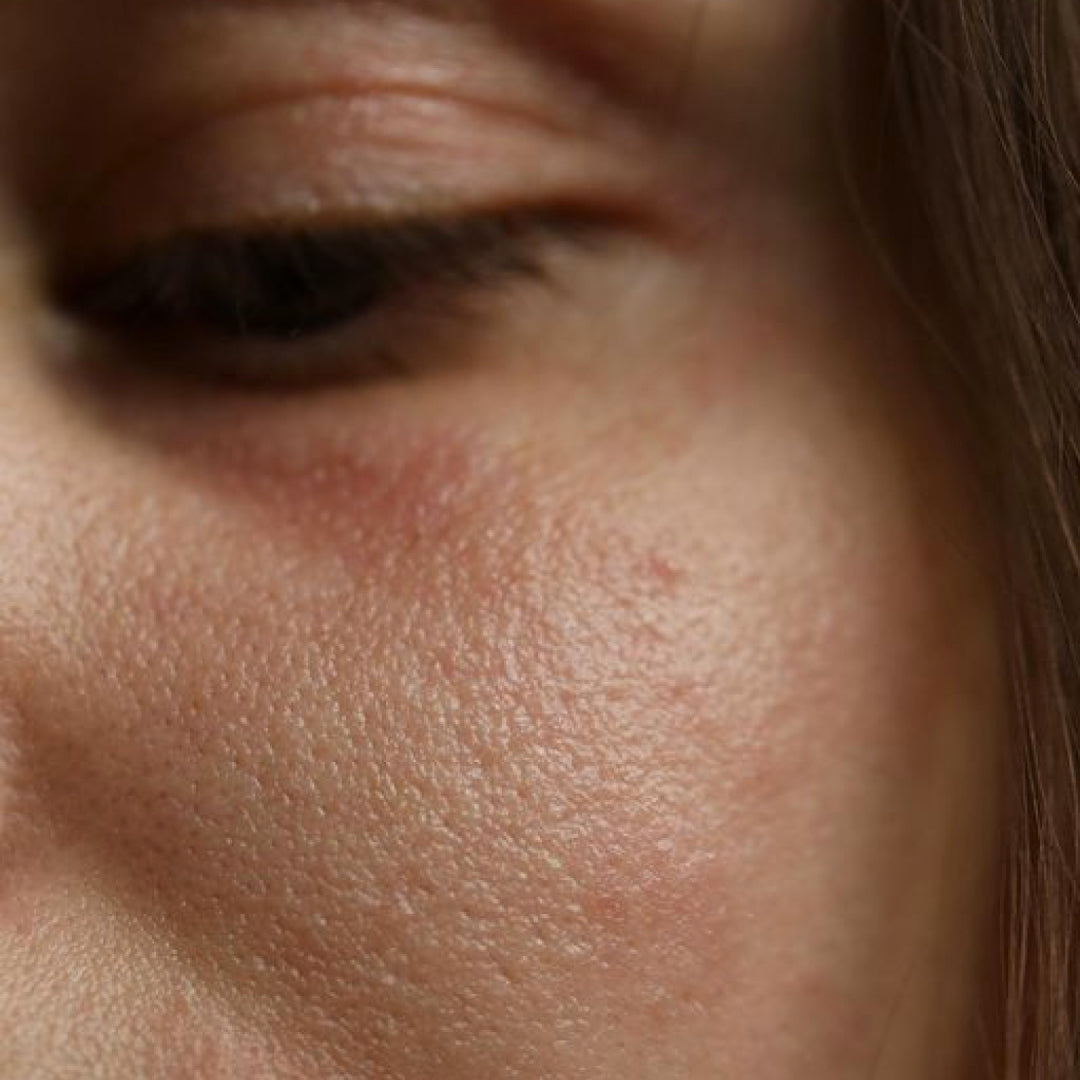 Image of LES EFFETS DU STRESS SUR NOTRE CORPS ET NOTRE PEAU