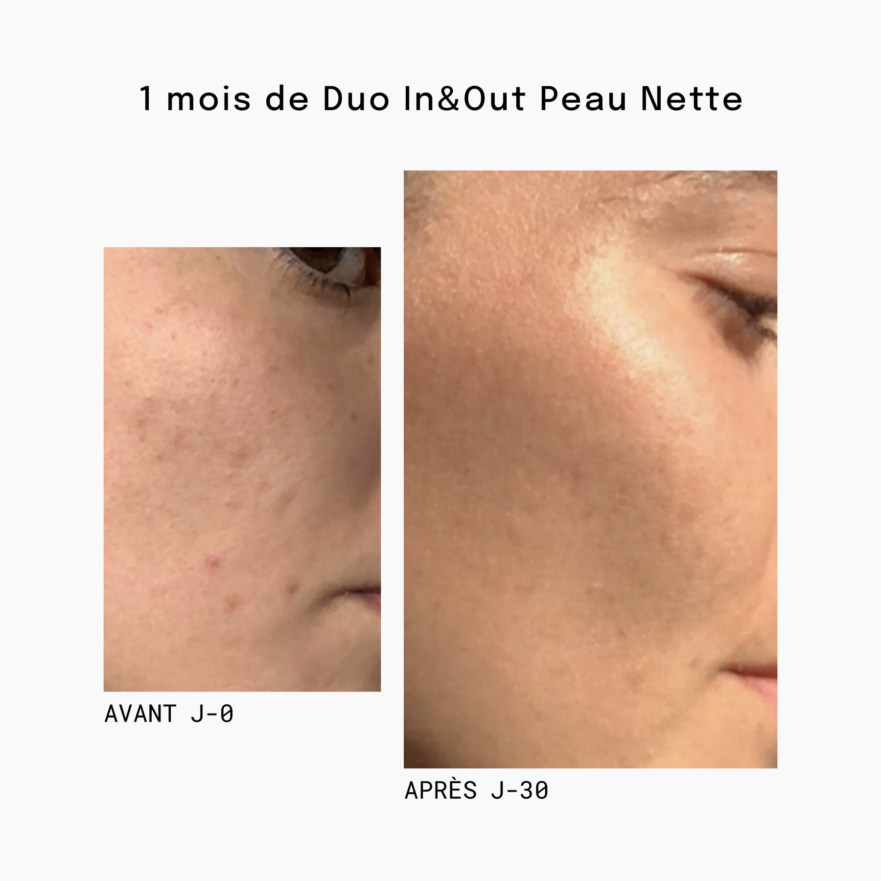 Duo In&Out Peau Nette